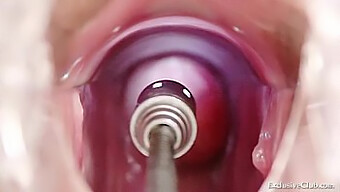 Intense Gape Close-Up As Blonde Babe Gets Examined And Enema